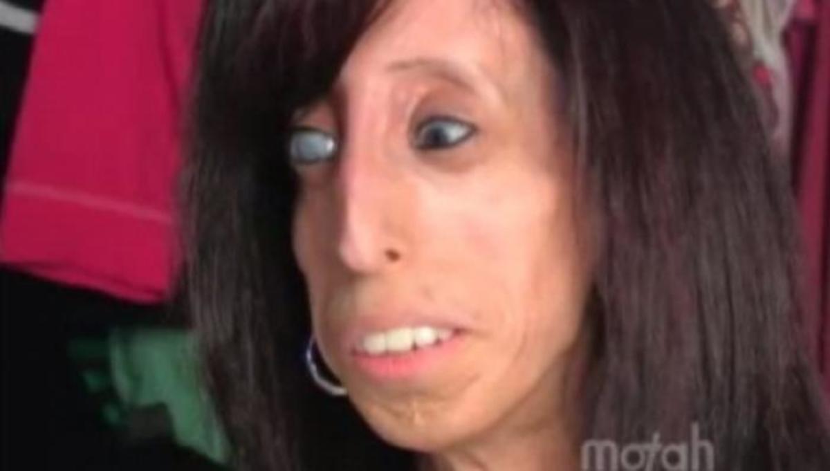 Πρέπει να τρώει κάθε 15 λεπτά αλλιώς θα πεθάνει!