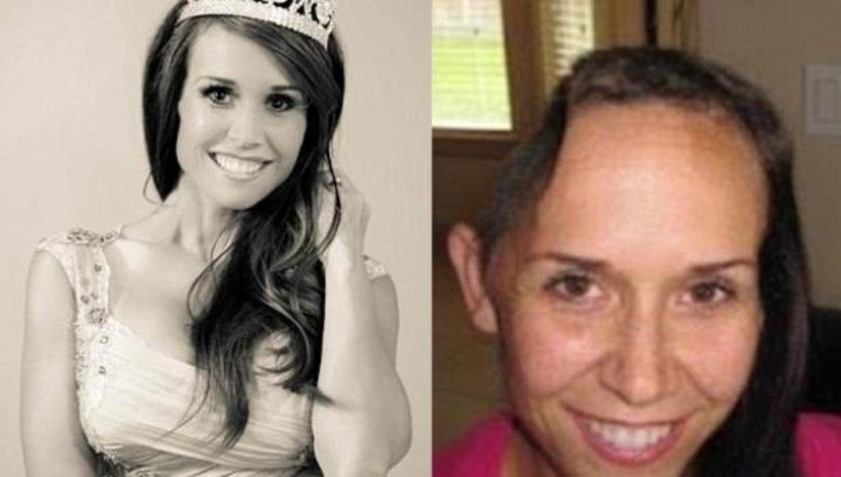 Μια βασίλισσα ομορφιάς δίχως κρανίο… – ΦΩΤΟ