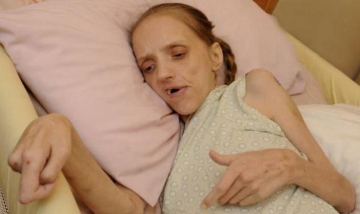 Σοκάρουν οι φωτογραφίες της 35χρονης ετοιμοθάνατης μητέρας!