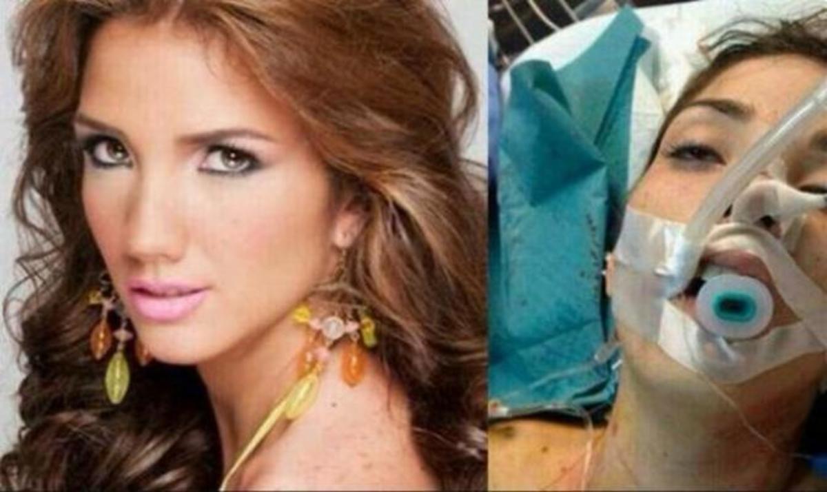 Βενεζουέλα: Νεκρή η βασίλισσα ομορφιάς Καρμόνα. Την πυροβόλησαν στο κεφάλι σε αντικυβερνητική διαδήλωση