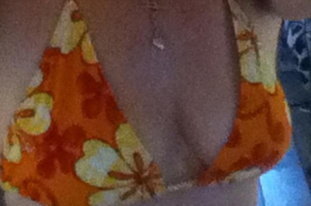 Σοκάρει η περιπέτεια της γυμνάστριας!  Ένιωσε ξαφνικά να «σκάνε» τα στήθη της