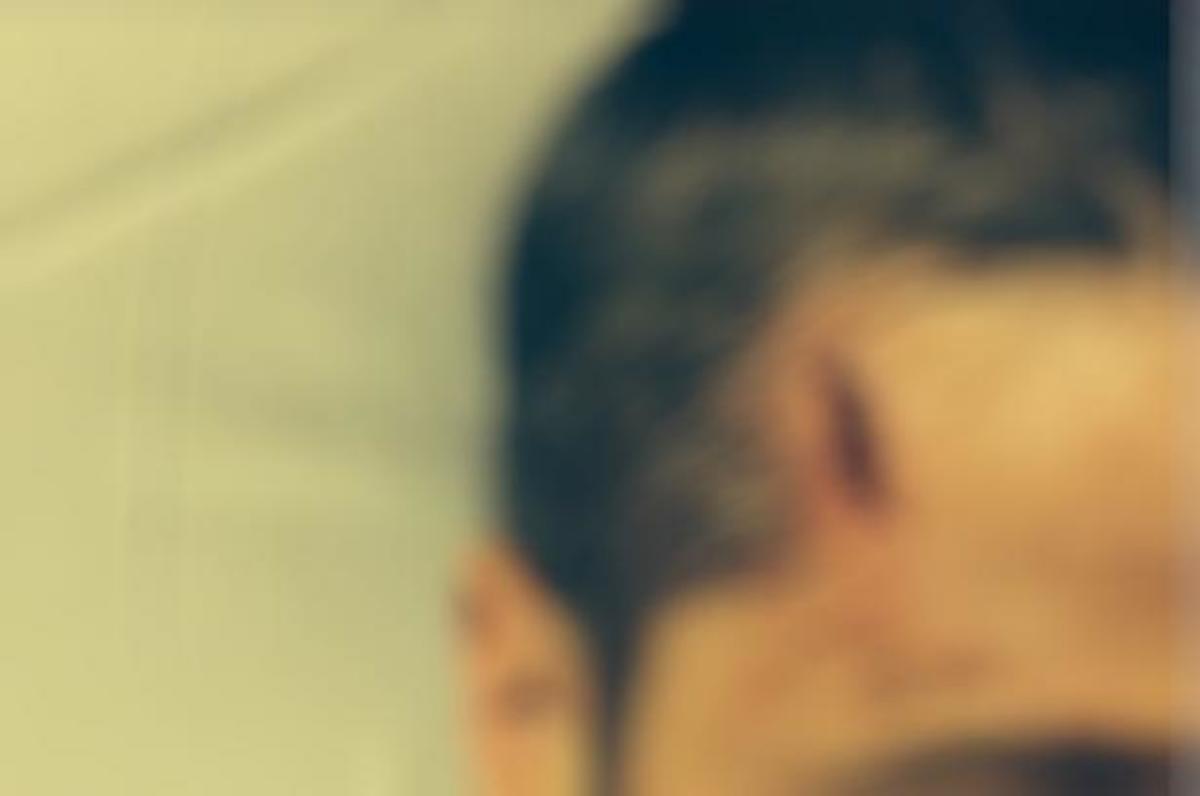 Ηθοποιός έκανε ράμματα στο κεφάλι και ανέβασε selfie