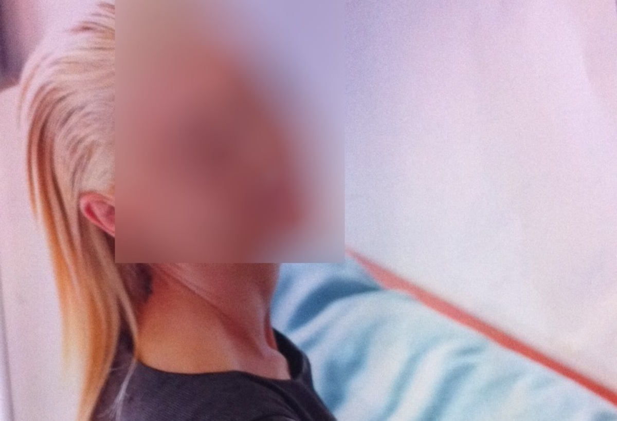 «Έκανα πλαστική δύο φορές»