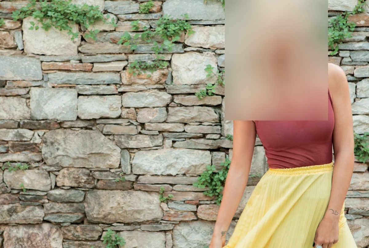 «Υποχρεώθηκα να κάνω botox γιατί φαινόμουν μονίμως θυμωμένη»!
