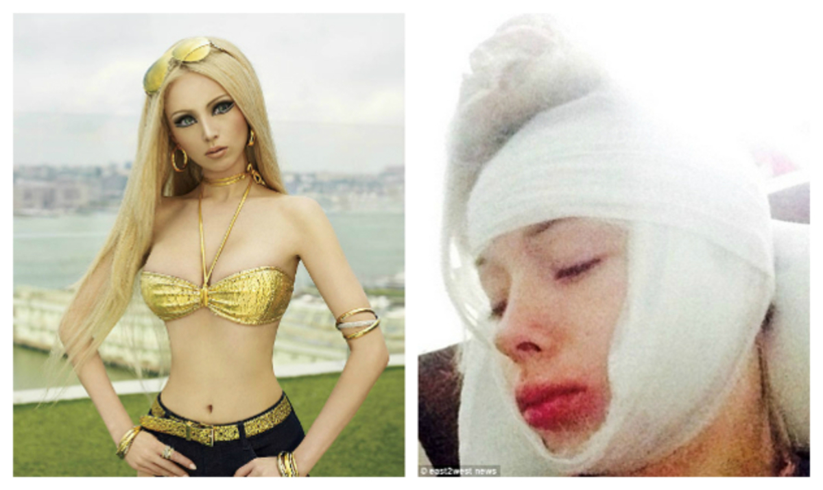 Χτύπησαν άγρια την ζωντανή Barbie!