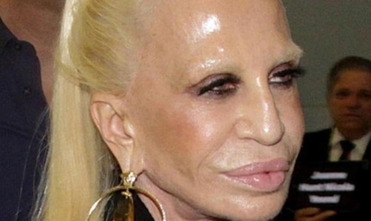 Donatella Versace: Πιο παραμορφωμένη από ποτέ!