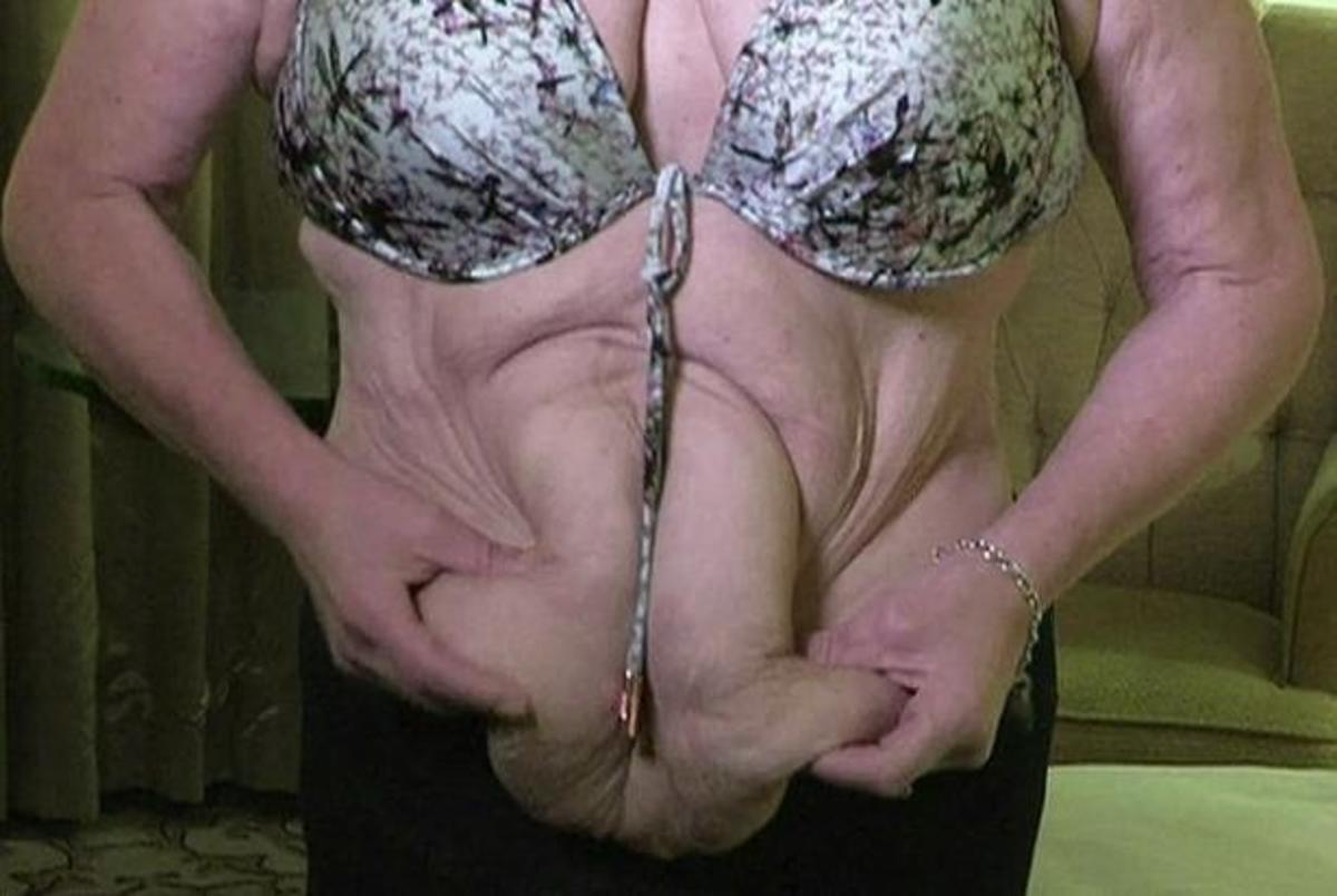 Η ηθοποιός που έχασε το βάρος ενός ανθρώπου!