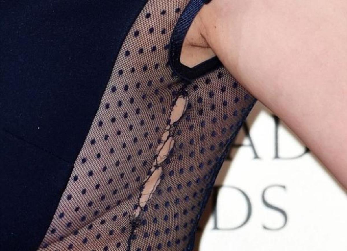 Με σκισμένο φόρεμα και αξύριστη μασχάλη στα βραβεία BAFTA!