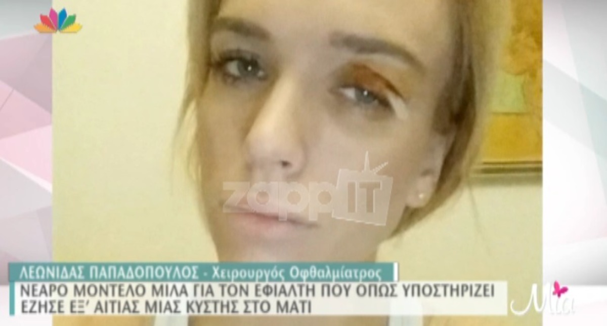 Εβελίνα Παρουζέλ: Το πρόβλημα στο μάτι της που την ταλαιπώρησε