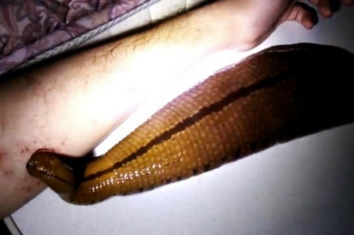 Έχει για κατοικίδιο μία βδέλλα που του πίνει το αίμα!