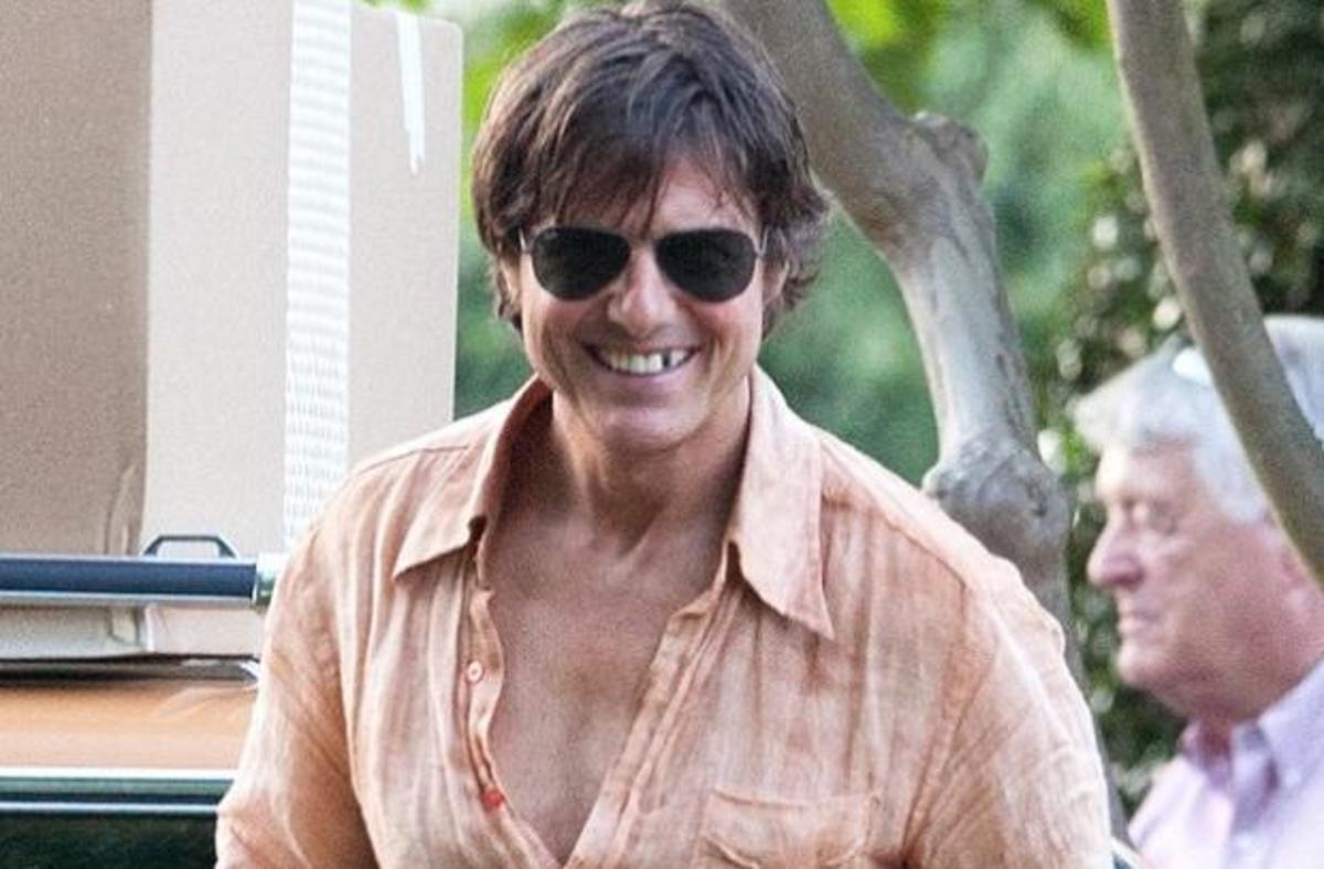Με σπασμένο δόντι και μελανιές το Tom Cruise!