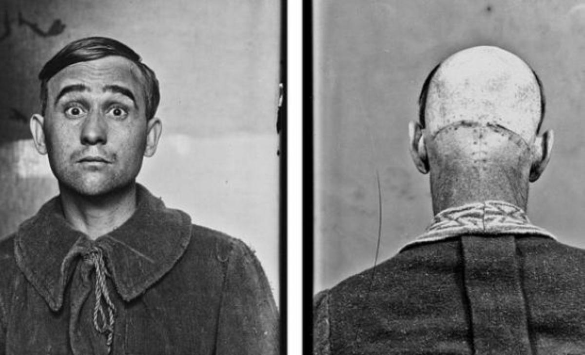 Οι πρώτοι ασθενείς που υποβλήθηκαν σε εγχείρηση εγκεφάλου!