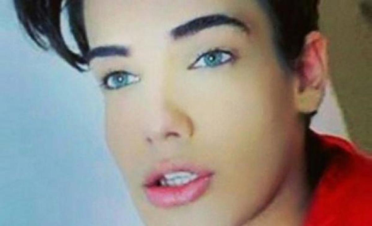 Πέθανε ο νεαρός Βραζιλιάνος που ήθελε να μοιάσει στην κούκλα «Κεν»