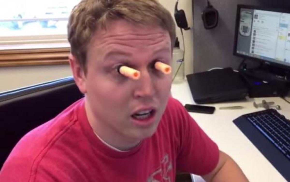 Κόλλησε στα μάτια του βεντούζες και κάνει θραύση!