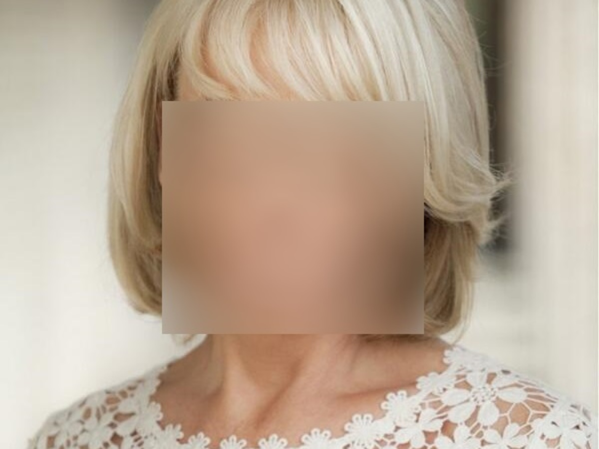 Έκανε λίφτινγκ και αυτό είναι το αποτέλεσμα!