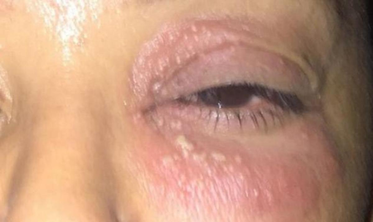 Παραμορφώθηκε η τραγουδίστρια! Τι συνέβη;