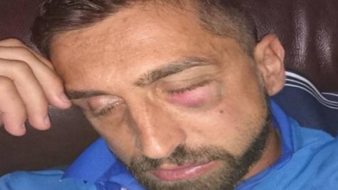 Γιατροί για κλάματα! Αντί να τον εγχειρίσουν, του έδωσαν παυσίπονα (VIDEO – ΦΩΤΟ)