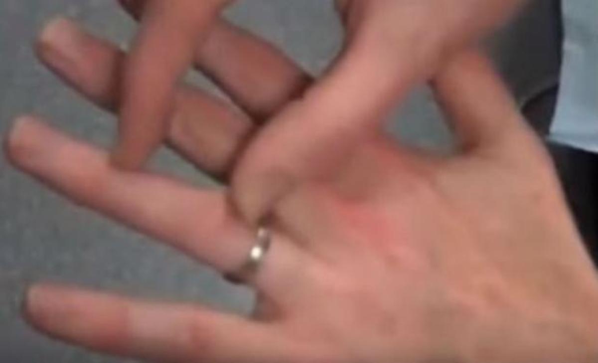 Δείτε έναν εύκολο τρόπο για να βγάλετε ένα δαχτυλίδι…