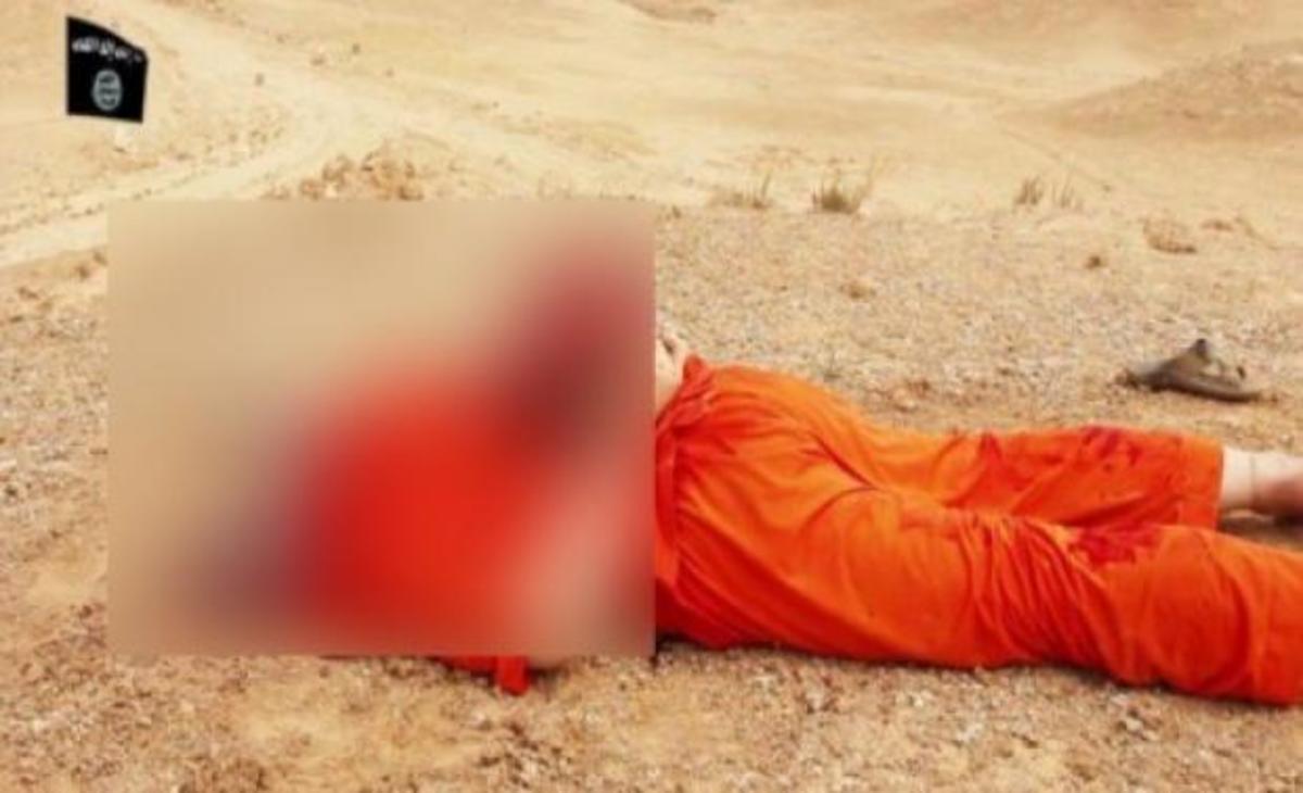 Η Λεπέν “ανέβασε” φρικιαστικές φωτογραφίες της… αρρώστιας των τζιχαντιστών!