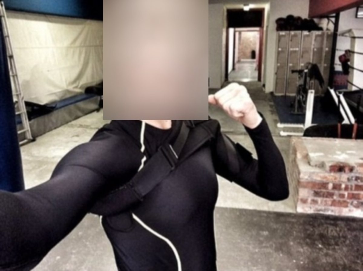 Σοκ! Θα ακρωτηριαστεί η ηθοποιός του Resident Evil εξαιτίας ατυχήματος!