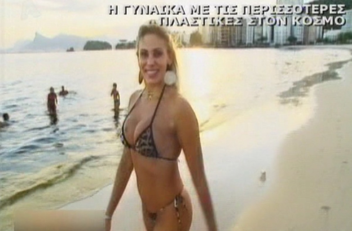 Γνωρίστε τη γυναίκα με τις περισσότερες πλαστικές στον κόσμο