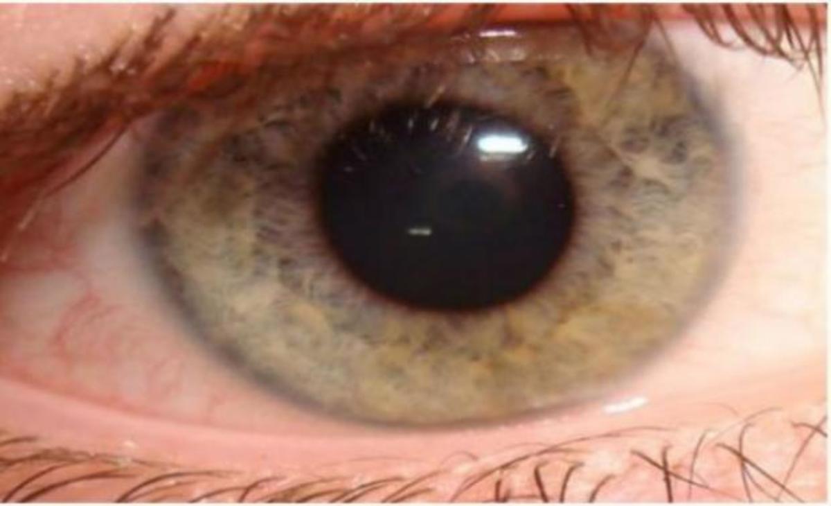 Πόσο καλή είναι η αντίληψη σας; Μόνο 1 στους 8 περνά αυτό το τεστ!