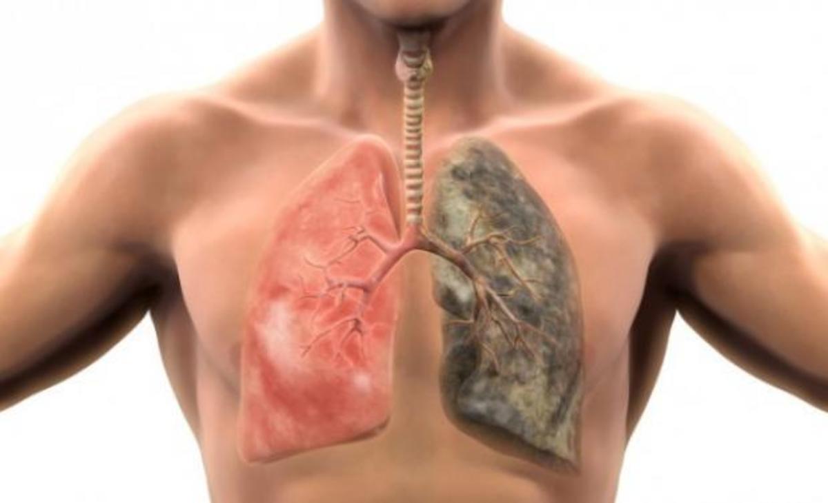 Σε πόσο καιρό θα καθαρίσουν οι πνεύμονες, αν κόψετε σήμερα το κάπνισμα