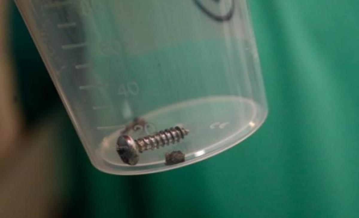 Βρυξέλλες: Εικόνες σοκ! Γεμάτες καρφιά και βίδες οι βόμβες των μακελάρηδων του αεροδρομίου και του Μετρό