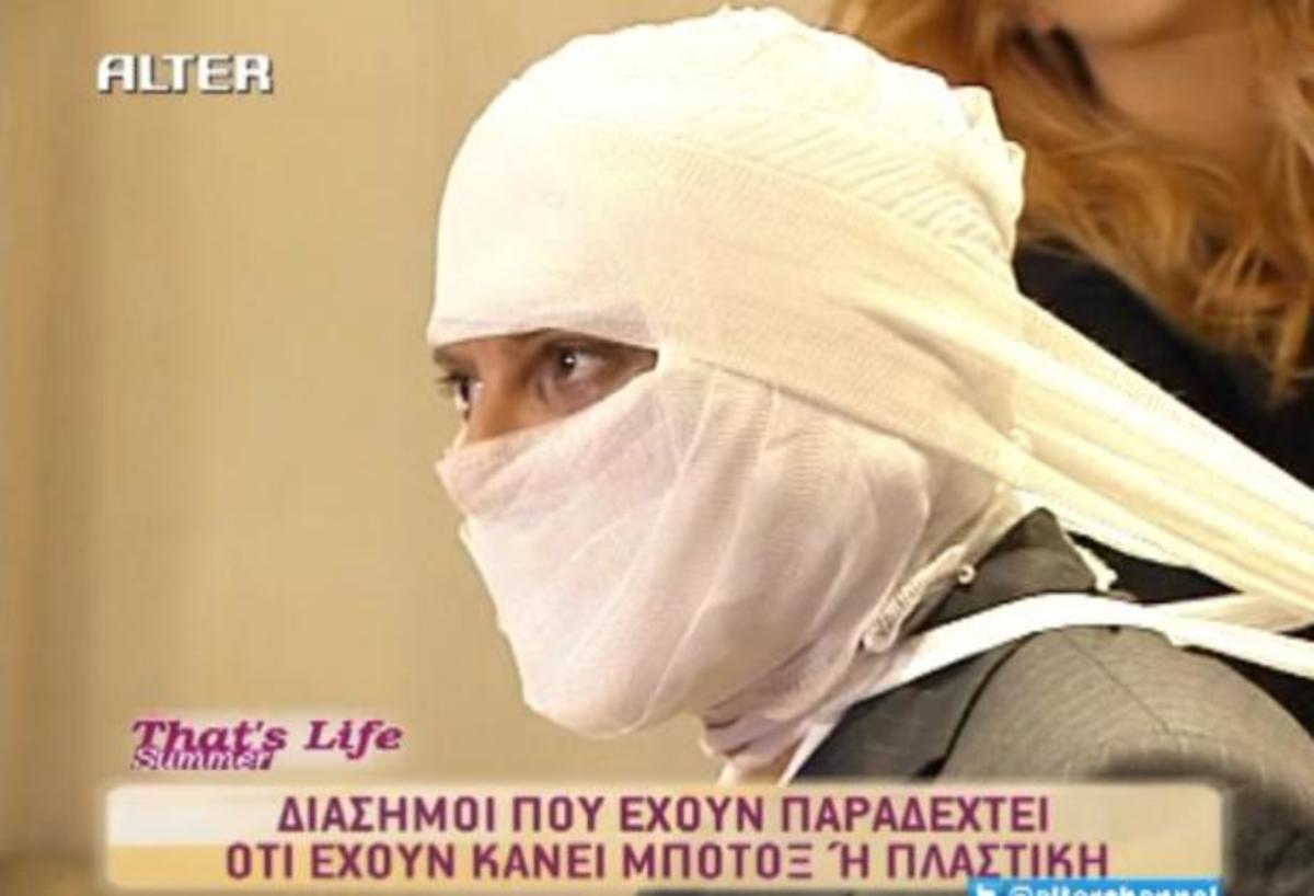 Ποιοι διάσημοι της ελληνικής showbiz έχουν παραδεχτεί ότι έχουν κάνει botox ή πλαστική;