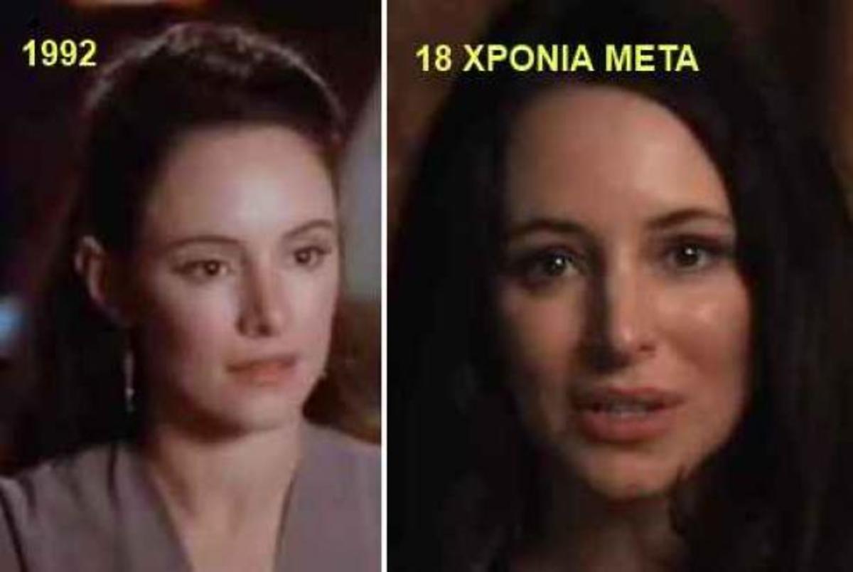 Madeleine Stowe: Καλά γονίδια ή… καλός πλαστικός;