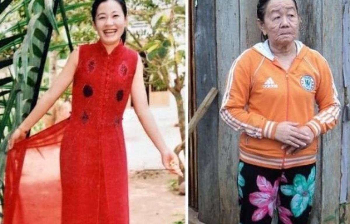 Ασύλληπτο! Γέρασε 30 χρόνια μέσα σε λίγες ημέρες