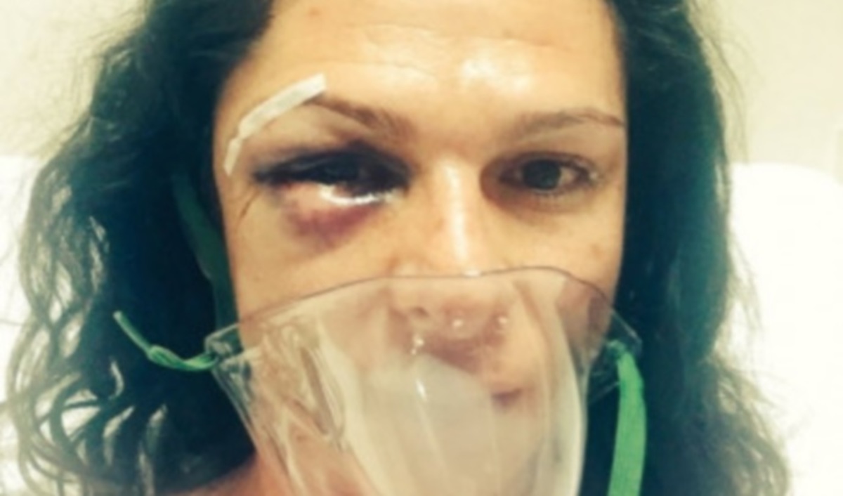 Αγριος ξυλοδαρμός σε Ολυμπιονίκη της Αθήνας