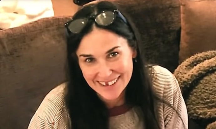 Η Demi Moore είπε ότι έχασε δόντια εξαιτίας αυξημένου στρες – Τι της… απαντούν οι επιστήμονες