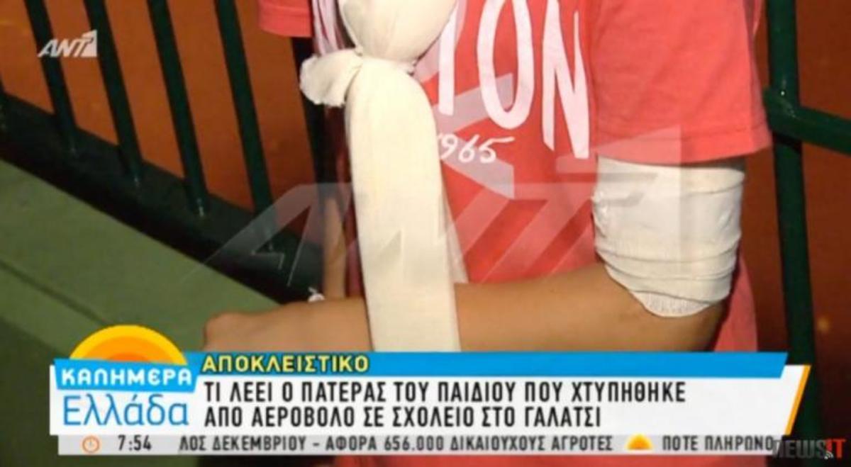 Γαλάτσι: Σοκαρισμένος ο πατέρας του 10χρονου που χτυπήθηκε με αεροβόλο – Οι ακτινογραφίες αποκάλυψαν τα πάντα