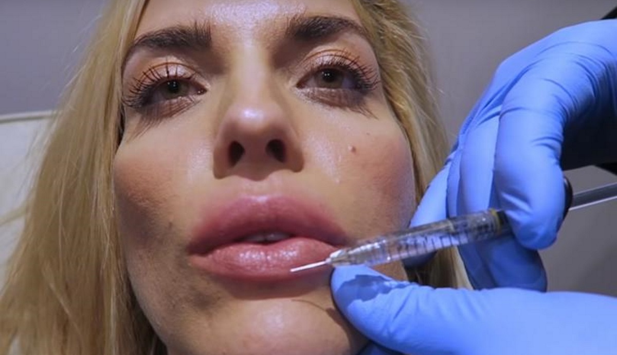 Μαντώ Γαστεράτου: Επισκέφθηκε τον πλαστικό χειρουργό και… φούσκωσε τα χείλη της on camera!