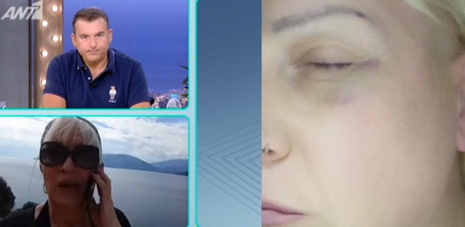 Βανέσα Κόττη