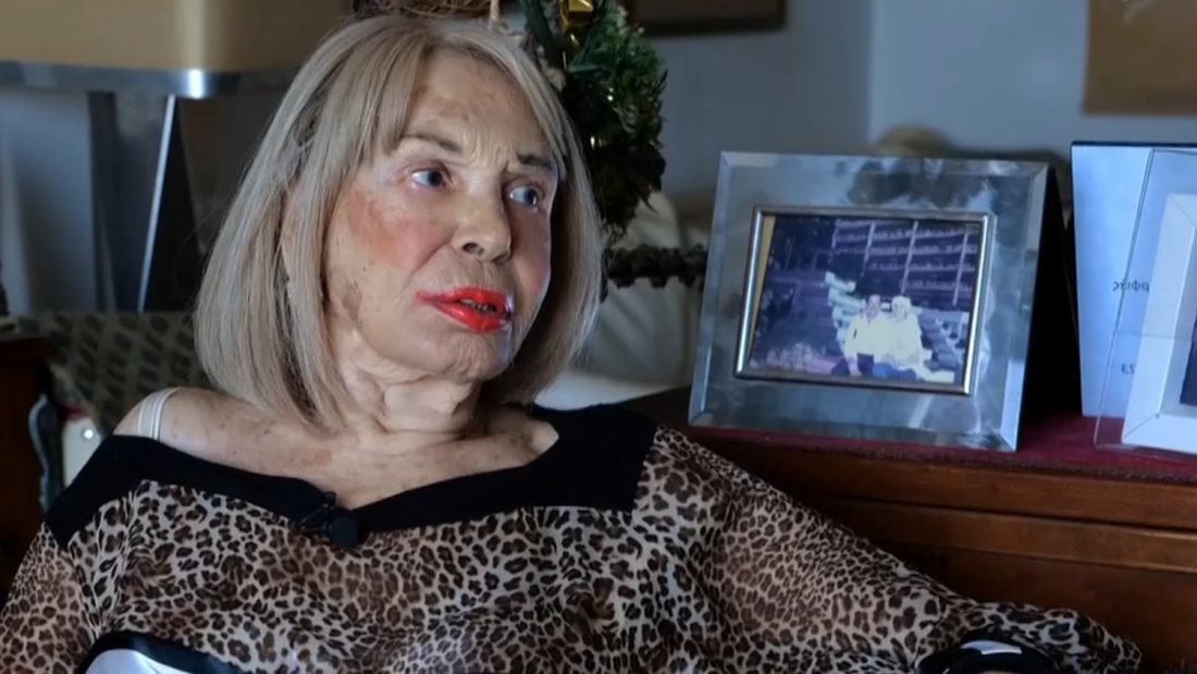 Ρίκα Διαλυνά