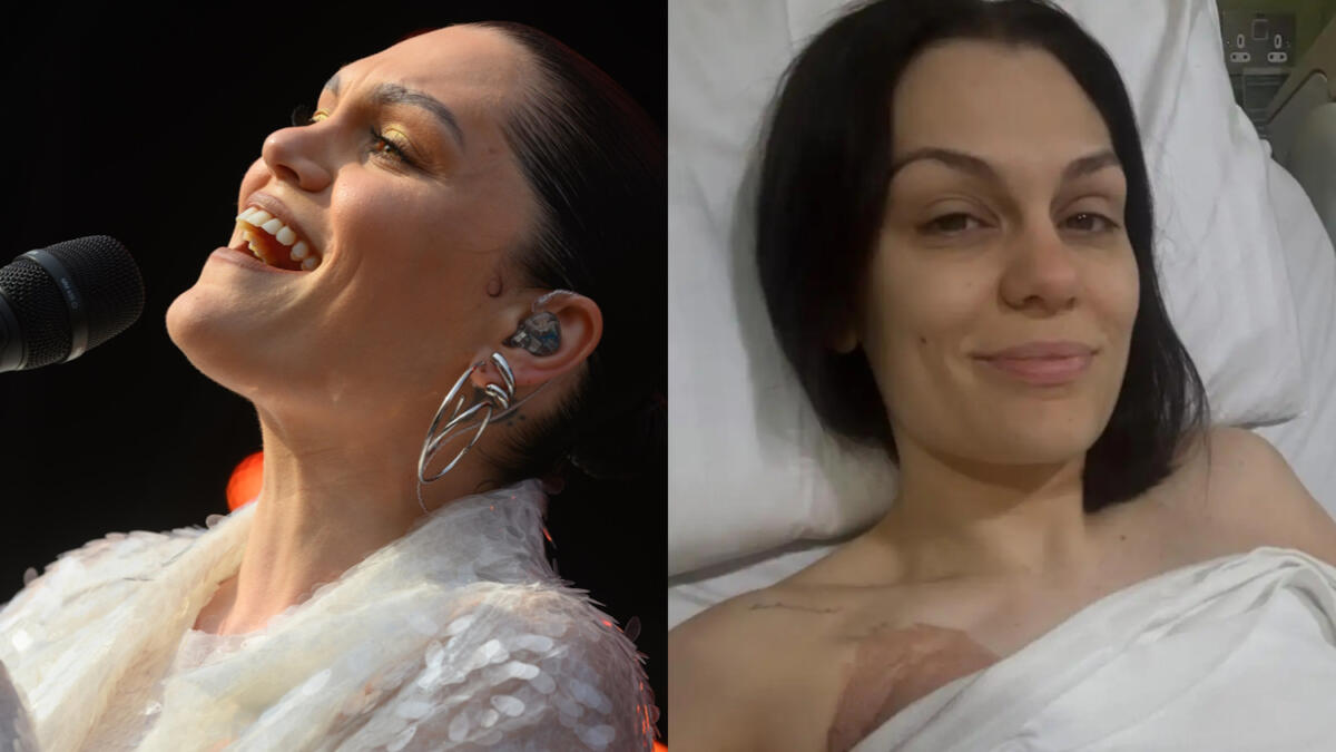 Jessie J